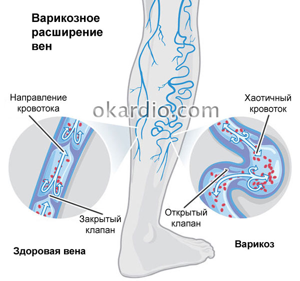 From what tablets Ascorutin: when it is effective, and when not