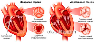 List of drugs from hypertension of the new generation: review of 5 drug groups