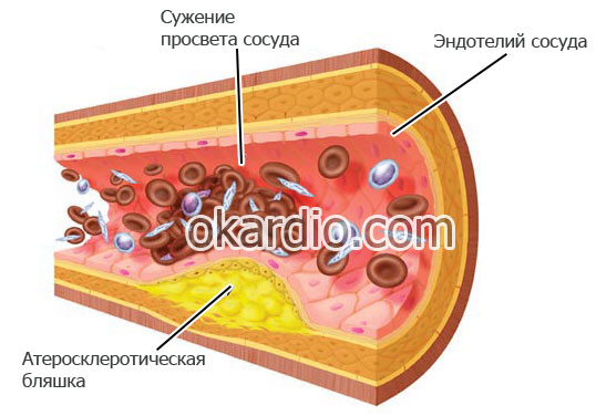 Overview of the main drugs that improve cerebral circulation
