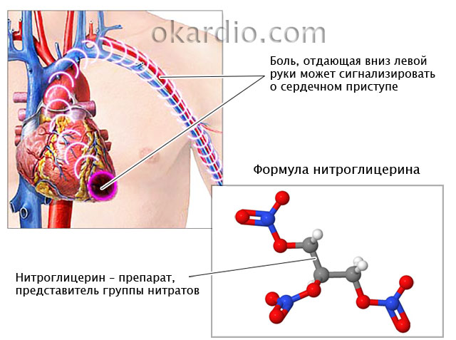 Sygdomme og symptomer, hvorfra nitroglycerin hjælper