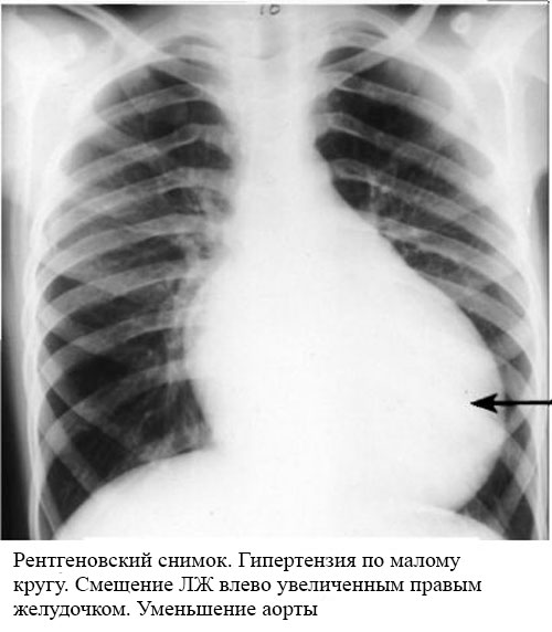 Full review of all types of adrenoblockers: selective, nonselective, alpha, beta